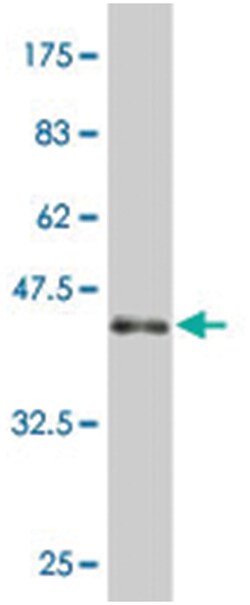 NOD1 (CARD4), Mouse, Polyclonal Antibody, Abnova 50&mu;L; Unlabeled:Antibodies,