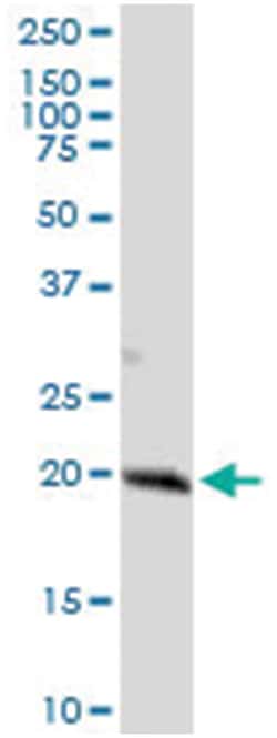 anti-ANAPC10, Human, IP-WB Antibody Pair, Abnova&trade;