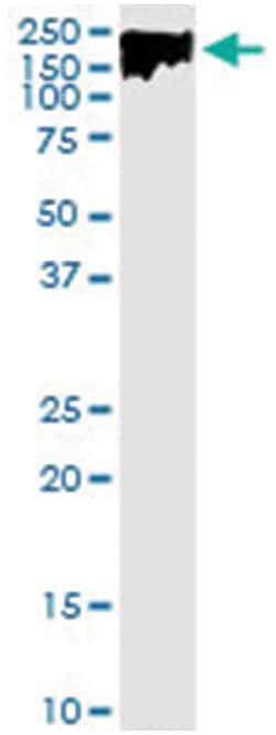 anti-DLC1, Human, IP-WB Antibody Pair, Abnova 1 Set:Antibodies, Monoclonal/Polyclonal