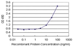 anti-IFITM3 Matched Antibody Pair, Abnova 1 Set:Antibodies
