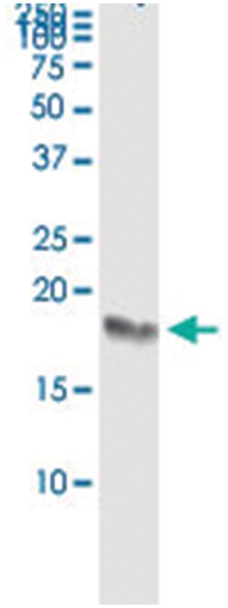 IFITM3, Human, IP-WB Antibody Pair (PW4), Abnova 1 Set | Buy Online | Abnova | Fisher Scientific