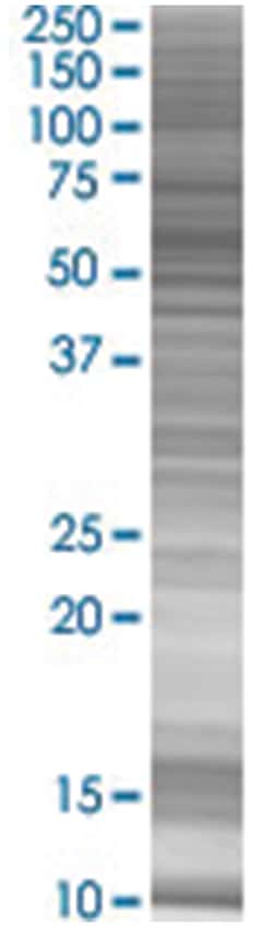 MCRS1 293T Cell Overexpression Lysate (Denatured), Abnova 100 &mu;l | Buy Online | Abnova | Fisher Scientific