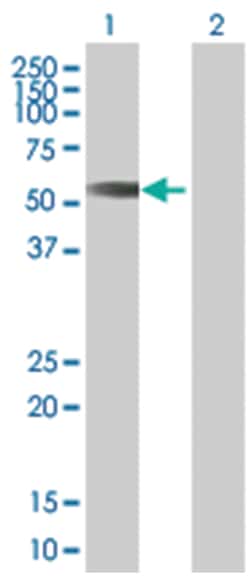 MCRS1 293T Cell Overexpression Lysate (Denatured), Abnova 100 &mu;l | Buy Online | Abnova | Fisher Scientific