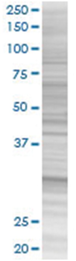 PPIE 293T Cell Overexpression Lysate (Denatured), Abnova 100 &mu;L | Buy Online | Abnova | Fisher Scientific