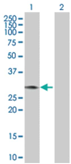 PPIE 293T Cell Overexpression Lysate (Denatured), Abnova