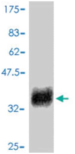 glycoprotein (transmembrane) nmb, Mouse, Polyclonal Antibody, Abnova 50&mu;L;