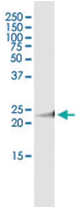 anti-MAD2L2, Human, IP-WB Antibody Pair, Abnova™