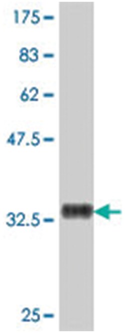 UBE2E3, Mouse, Polyclonal Antibody, Abnova 50&mu;L; Unlabeled:Antibodies,