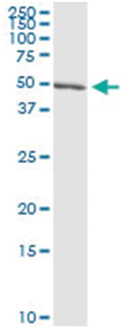 anti-CAP1, Human, IP-WB Antibody Pair, Abnova&trade;