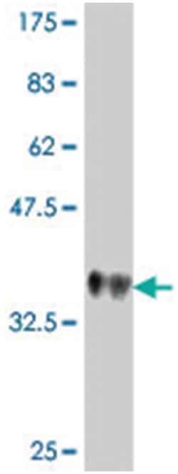 UNC13B, Mouse, Polyclonal Antibody, Abnova™