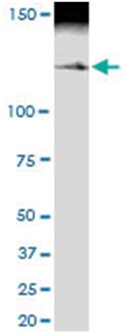 anti-MYBBP1A, Human, IP-WB Antibody Pair, Abnova&trade;