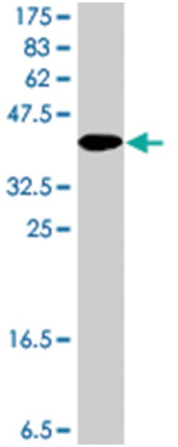 CIB2, Mouse, Polyclonal Antibody, Abnova 50&mu;L; Unlabeled:Antibodies,