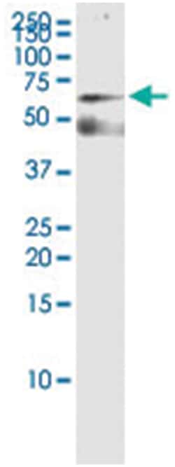 anti-KAT5, Human, IP-WB Antibody Pair, Abnova™