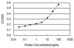 anti-RNASEH2A Matched Antibody Pair, Abnova™