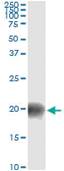 anti-BATF, Human, IP-WB Antibody Pair, Abnova 1 Set:Antibodies, Monoclonal/Polyclonal