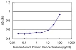 anti-DCTN2 Matched Antibody Pair, Abnova