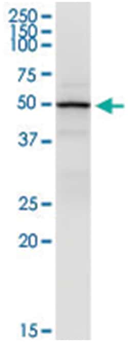 anti-DCTN2, Human, IP-WB Antibody Pair, Abnova 1 Set:Antibodies, Monoclonal/Polyclonal