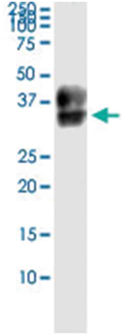 anti-PROCR, Human, IP-WB Antibody Pair, Abnova&trade;