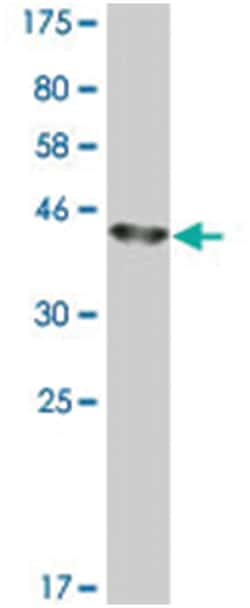 AGR2, Mouse, Clone: 7E9, Abnova 200&mu;L; Unlabeled:Antibodies, Monoclonal