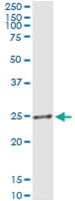 anti-AGPAT1, Human, IP-WB Antibody Pair, Abnova&trade;