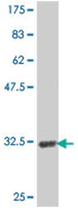 AGPAT2, Mouse, Polyclonal Antibody, Abnova 50 &mu;L | Buy Online | Abnova | Fisher Scientific