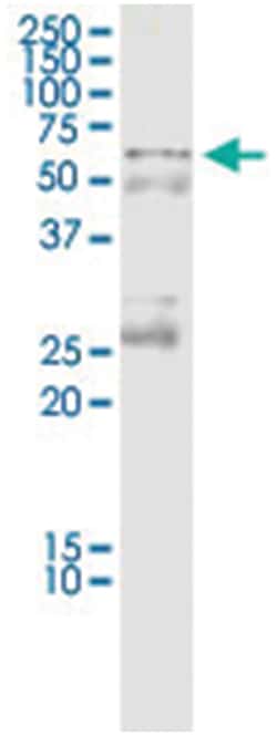 anti-CCT7, Human, IP-WB Antibody Pair, Abnova 1 Set:Antibodies, Monoclonal/Polyclonal