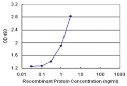 anti-SCGN Matched Antibody Pair, Ab-1, Abnova
