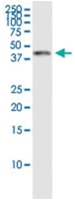 AHSA1, Human, IP-WB Antibody Pair (PW3), Abnova 1 Set:Antibodies, Monoclonal/Polyclonal