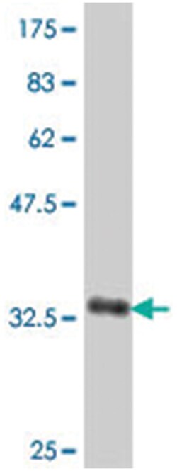 SLCO1B1, Mouse, Polyclonal Antibody, Abnova 50&mu;L; Unlabeled:Antibodies,
