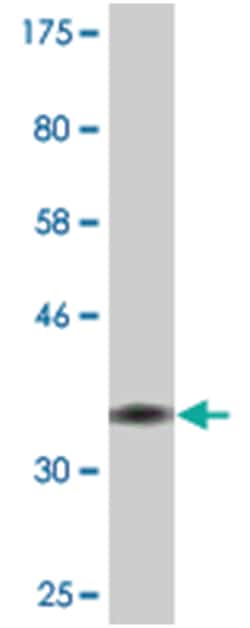 SPAG5, Mouse, Clone: 5F9, Abnova 200&mu;L; Unlabeled:Antibodies, Monoclonal