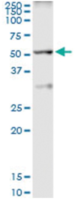 anti-TAF6L, Human, IP-WB Antibody Pair, Abnova&trade;