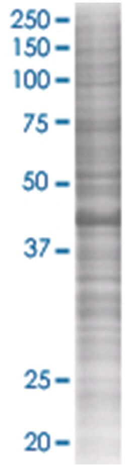 RAD51AP1 293T Cell Overexpression Lysate (Denatured), Abnova 100 &mu;L | Buy Online | Abnova | Fisher Scientific