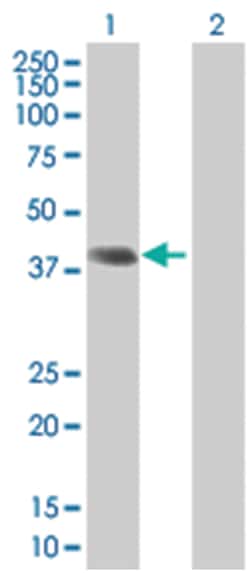RAD51AP1 293T Cell Overexpression Lysate (Denatured), Abnova 100 &mu;L | Buy Online | Abnova | Fisher Scientific