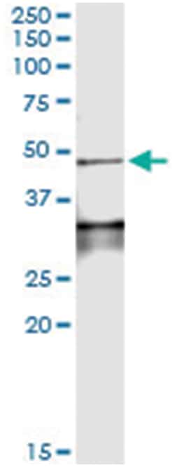 anti-LEFTY1, Human, IP-WB Antibody Pair, Abnova&trade;