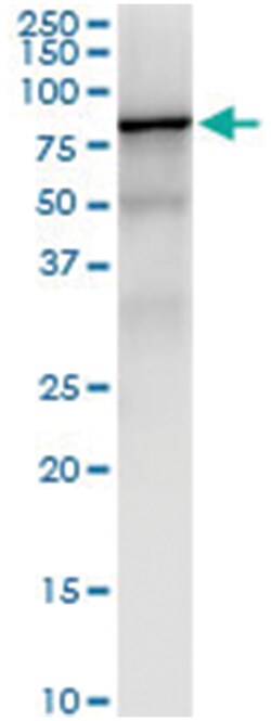 IGF2BP2, Human, IP-WB Antibody Pair (PW1), Abnova™