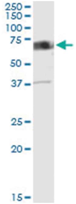 CAMKK2, Human, IP-WB Antibody Pair (PW2), Abnova 1 Set:Antibodies, Monoclonal/Polyclonal