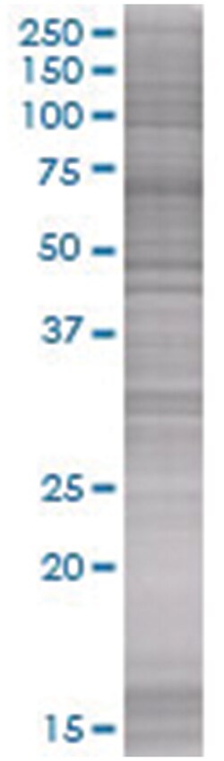 SPINT2 293T Cell Overexpression Lysate 2 (Denatured), Abnova 100 &mu;L | Buy Online | Abnova | Fisher Scientific