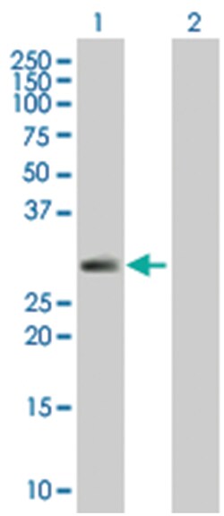 SPINT2 293T Cell Overexpression Lysate 2 (Denatured), Abnova 100 &mu;L | Buy Online | Abnova | Fisher Scientific