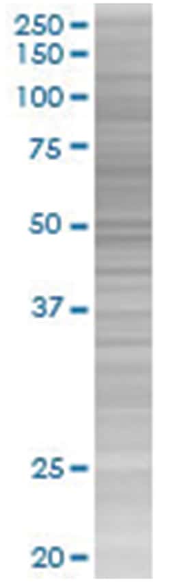 SPINT2 293T Cell Overexpression Lysate 4 (Denatured), Abnova 100 &mu;L | Buy Online | Abnova | Fisher Scientific