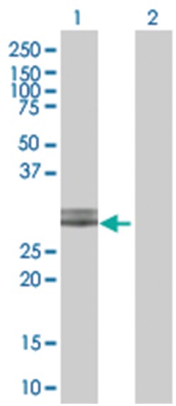 SPINT2 293T Cell Overexpression Lysate 4 (Denatured), Abnova 100 &mu;L | Buy Online | Abnova | Fisher Scientific