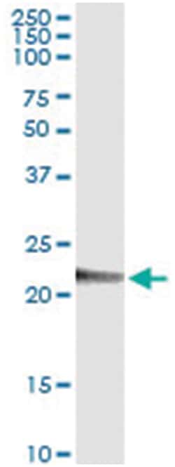 PMVK, Human, IP-WB Antibody Pair (PW1), Abnova&trade;