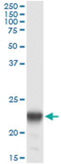 PMVK, Human, IP-WB Antibody Pair (PW2), Abnova&trade;
