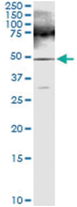 anti-FARS2, Human, IP-WB Antibody Pair, Abnova 1 Set:Antibodies, Monoclonal/Polyclonal