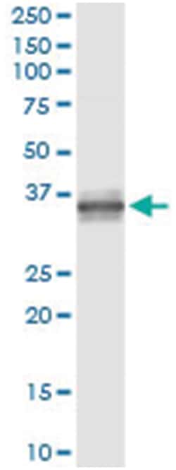 TNFSF13B, Human, IP-WB Antibody Pair (PW1), Abnova&trade;