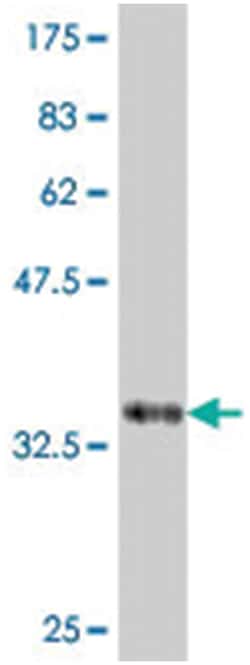 chondroitin sulfate proteoglycan 5 (neuroglycan C), Mouse, Polyclonal Antibody, Abnova&trade;