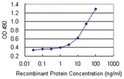anti-PNMA2 Ab-1 Matched Antibody Pair, Abnova&trade;