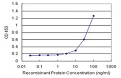 anti-CCT6B Matched Antibody Pair, Ab-1, Abnova