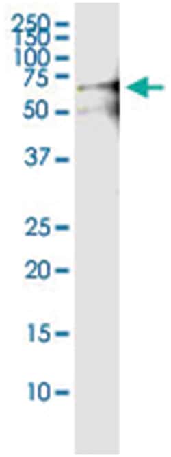anti-CCT6B, Human, IP-WB Antibody Pair, Abnova&trade;