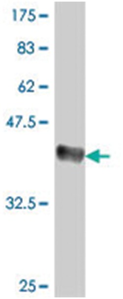 NFAT5, Mouse, Polyclonal Antibody, Abnova™