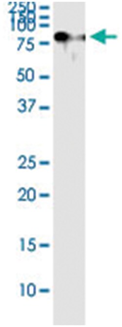 anti-TRAF3IP2, Human, IP-WB Antibody Pair, Abnova™